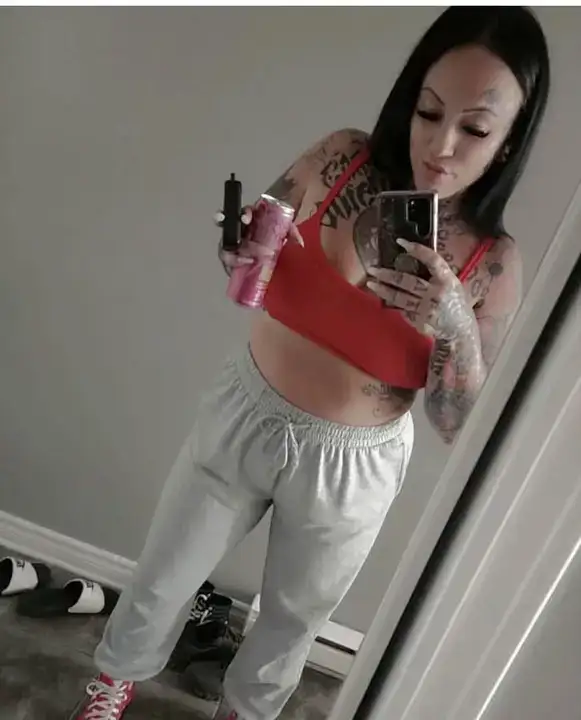 Antalya’daki Estetik Operasyonu Felaketle Bitti 5